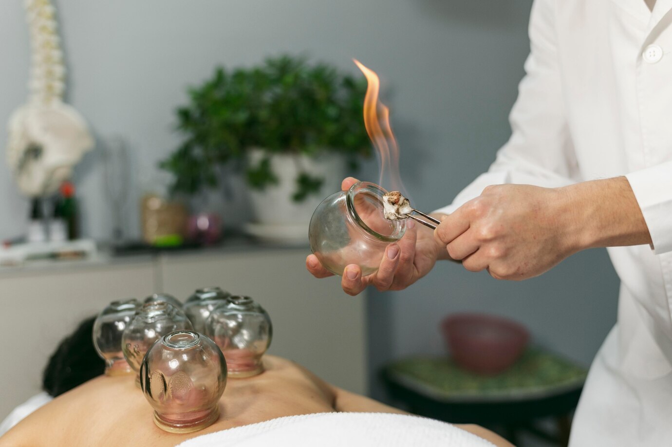 Fire Cupping therapies